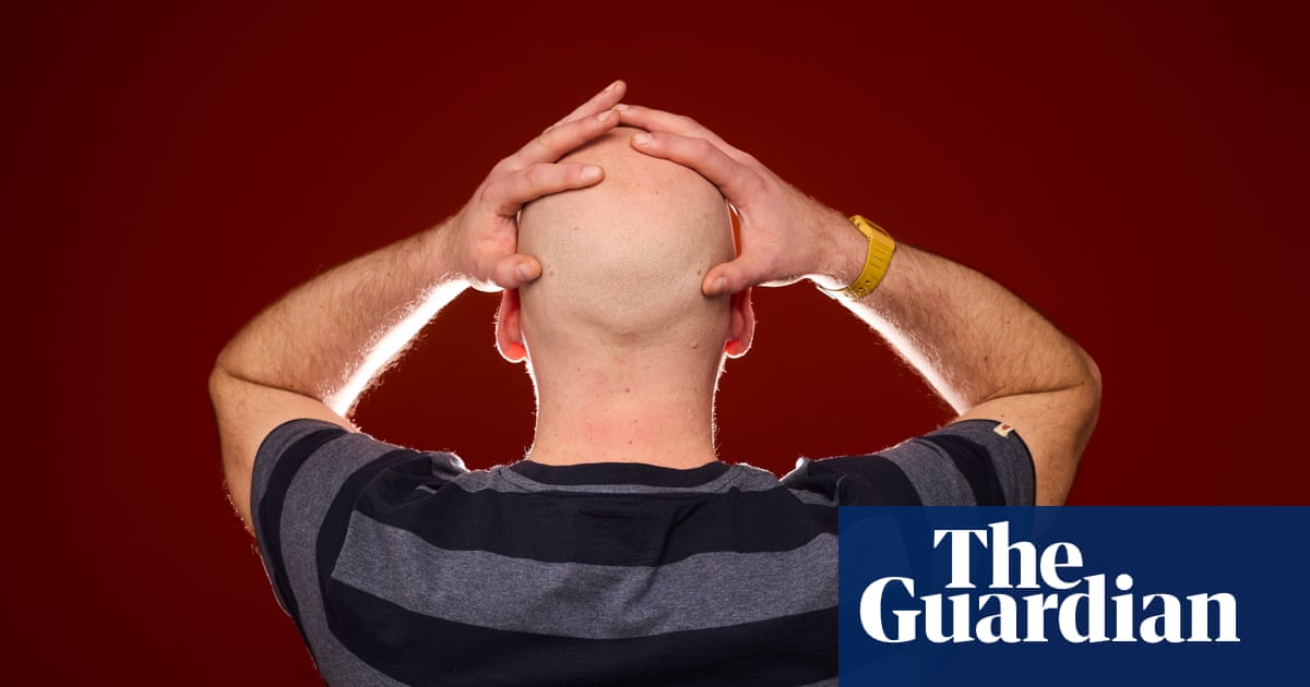 Going bald in an more and more furry world – podcast | Hair loss