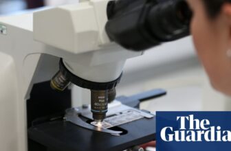 Swab check may assist UK ladies keep away from invasive checks for womb most cancers | Girls’s well being
