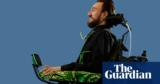 The person with Elon Musk’s chip in his mind – podcast | Elon Musk